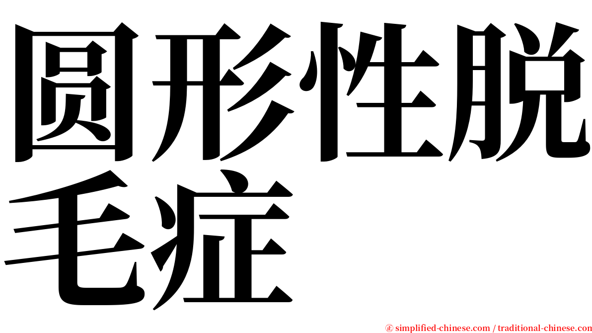 圆形性脱毛症 serif font